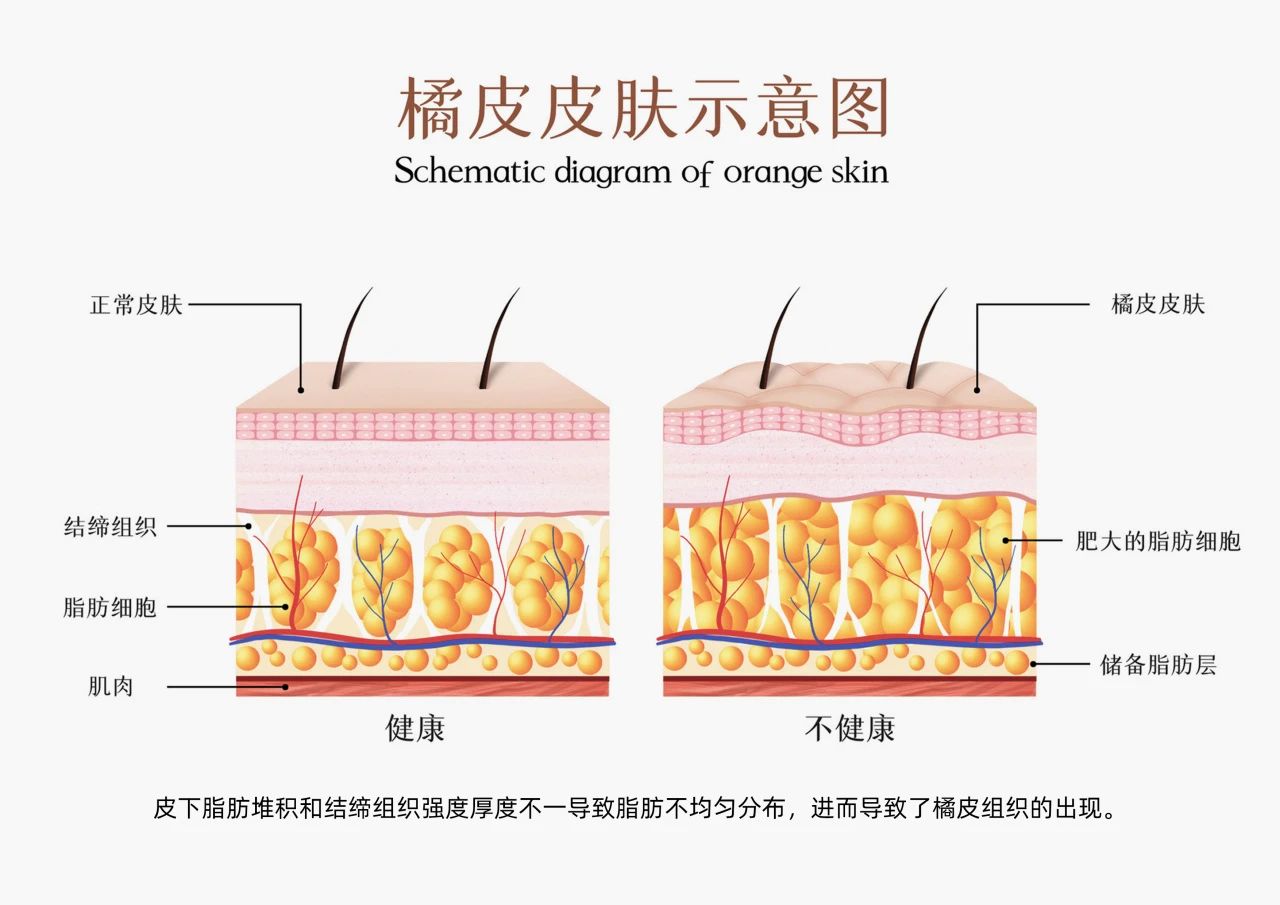 诚一重磅引进新型体控原料！(图2)