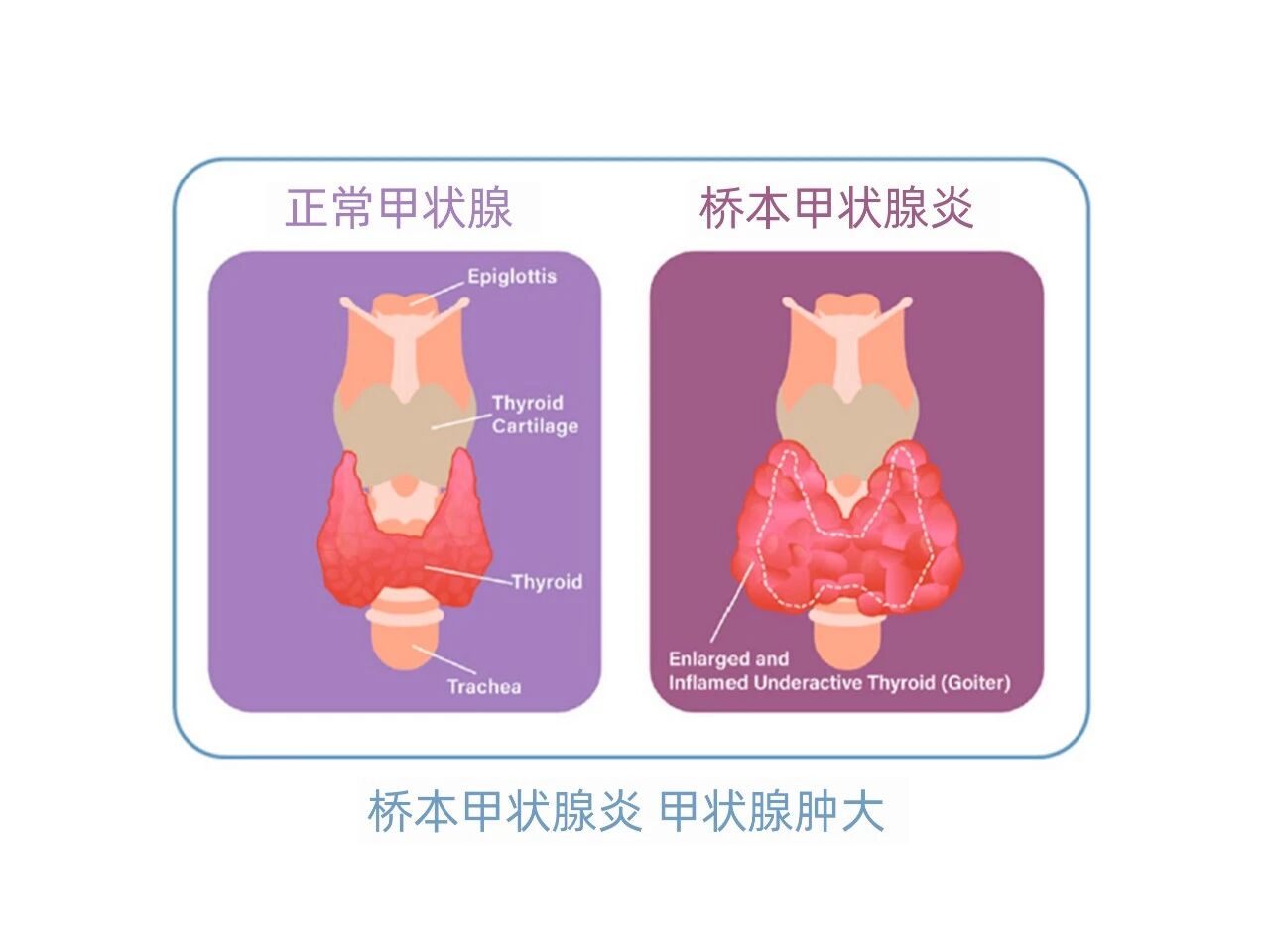 膳食纤维前沿研究荣登权威期刊！开辟2亿甲状腺炎人群干预新蓝海！(图3)